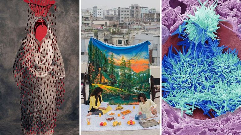 Welcome Photography Prize 2025: Where Photography Meets Science, Health, and Humanity